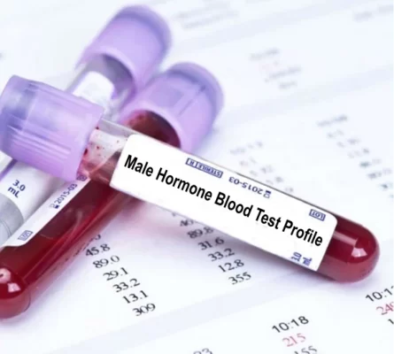Male Hormone Blood Test Image