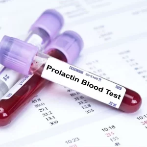 Prolactin Blood Test