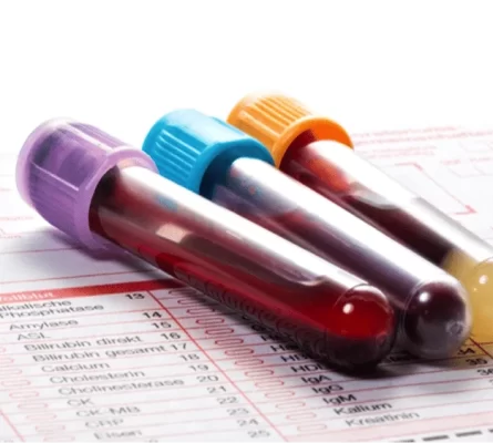 Men's Blood Tests