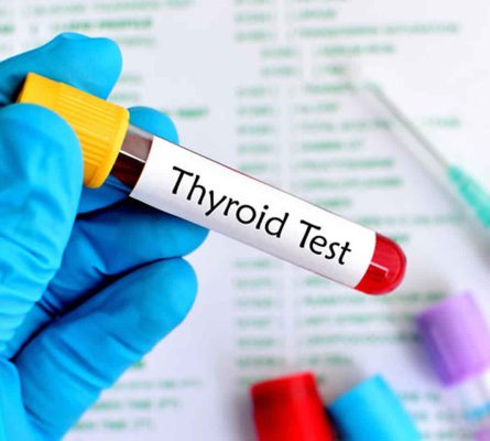Advanced Thyroid Function Blood Test