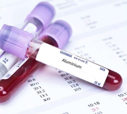 Aluminium Blood Test