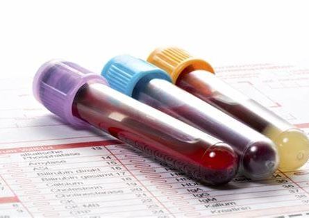 Cardiovascular Risk Profile Blood Test