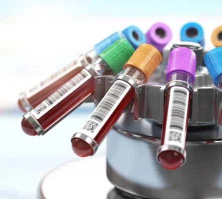 Female Fertility Blood Tests