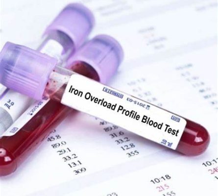 Iron Overload Profile Blood Test