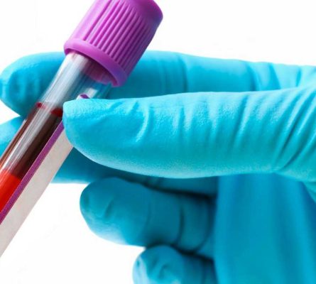 Longevity Blood Tests