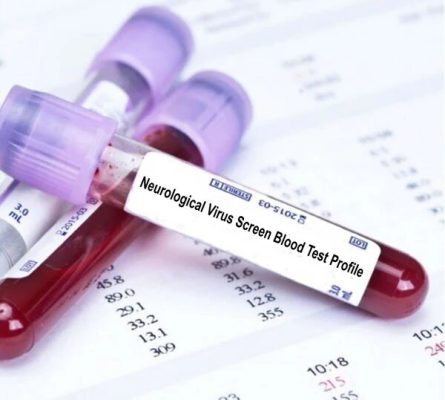 Neurological Viral Screen Blood Test