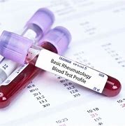 Rheumatology Profile Blood Test