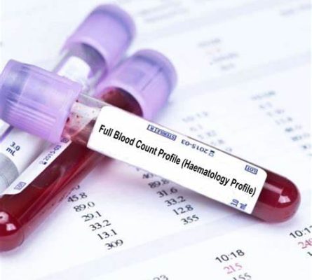 Haematology Profile Blood Test