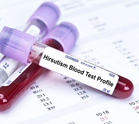 Hirsutism Profile Blood Test