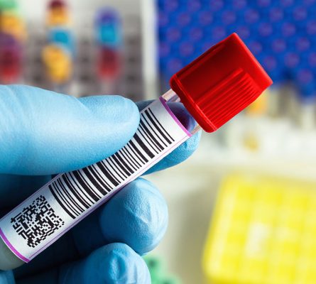 Serology Blood Test