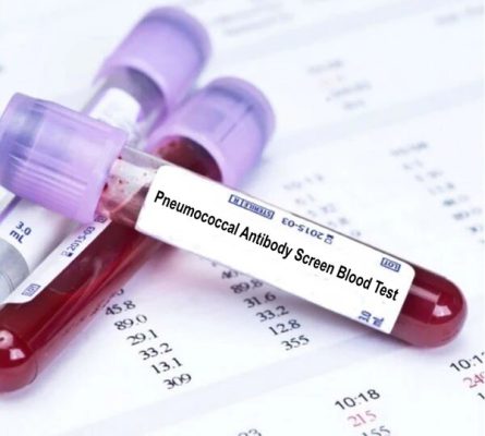 Viral Antibody Screen Blood Test