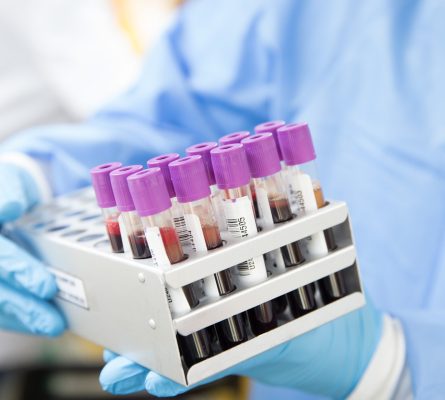 Women's Blood Tests