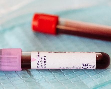 Myeloma screen Blood Test