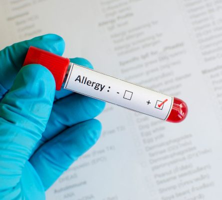 Allergy Screen (Finfish) Blood Test