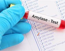 Amylase Blood Test