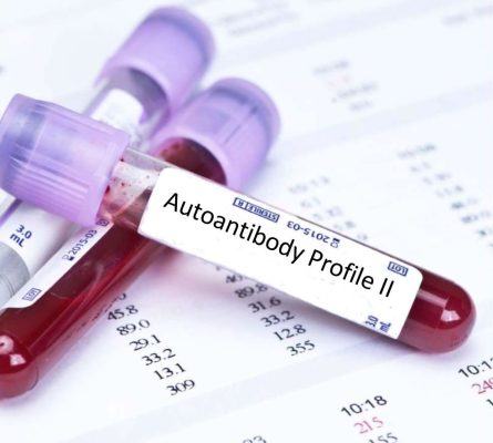 Autoantibody Profile 2 Blood Test