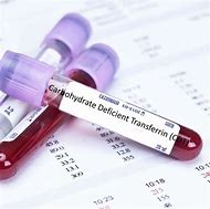 Carbohydrate Deficient Transferrin Blood Test