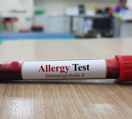 Combined Shellfish/Finfish Allergy Blood Test