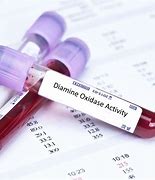 Diamine Oxidase Activity Blood Test