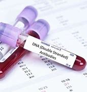 Double-stranded DNA antibodies (DsDNA) Blood Test