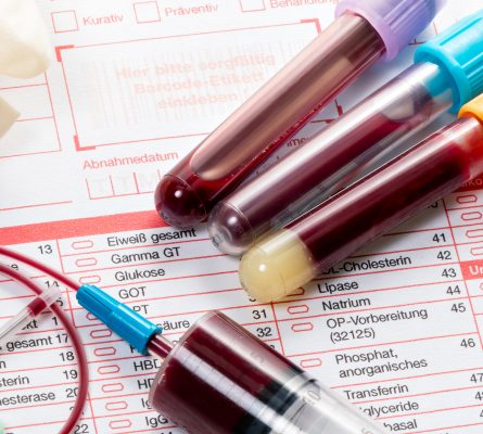 Energy Blood Tests