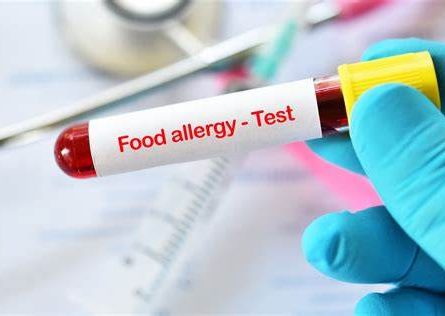 Food Allergy Blood Test