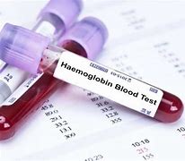 Haemoglobin Blood Test