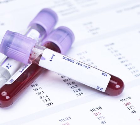 Heart Health Blood Tests