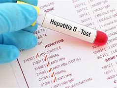 Hepatitis B Immunity Blood Test