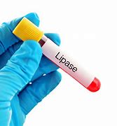 Lipase Blood Test