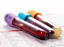 MMR Immunity IgG,IgM Blood Test