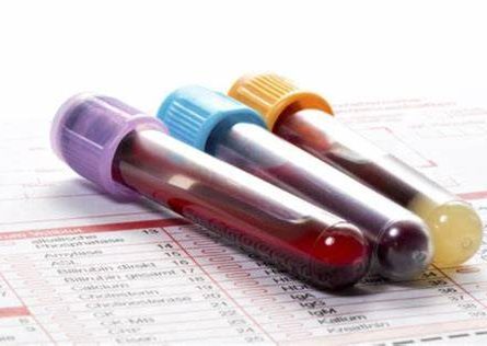 Nutrition Blood Tests