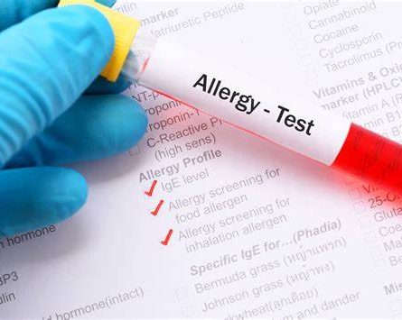 Allergy Screen (Antibiotics) Blood Test