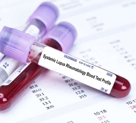 Rheumatology Profile 4 (Systemic Lupus) Blood Test