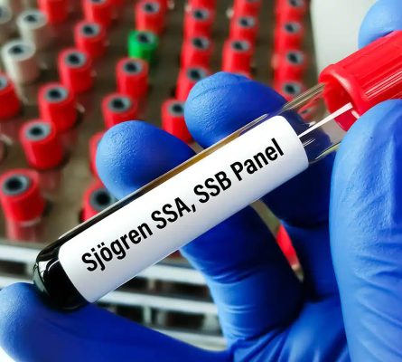 Rheumatology Profile 7 (Sjogren’s Syndrome) Blood Test